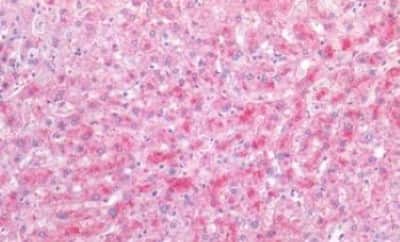 Immunohistochemistry-Paraffin: VEGF 165 Antibody [NBP3-14566] - Human Liver: Formalin-Fixed, Paraffin-Embedded (FFPE)